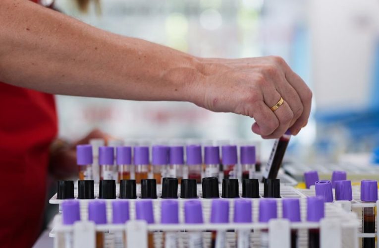 La Comunidad de Madrid hace un llamamiento urgente para donar sangre y aumentar las reservas