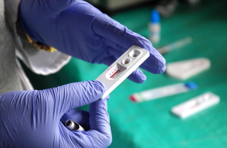 La Comunidad de Madrid aumenta más de un 8% las personas atendidas en su red de prevención de infecciones de transmisión sexual