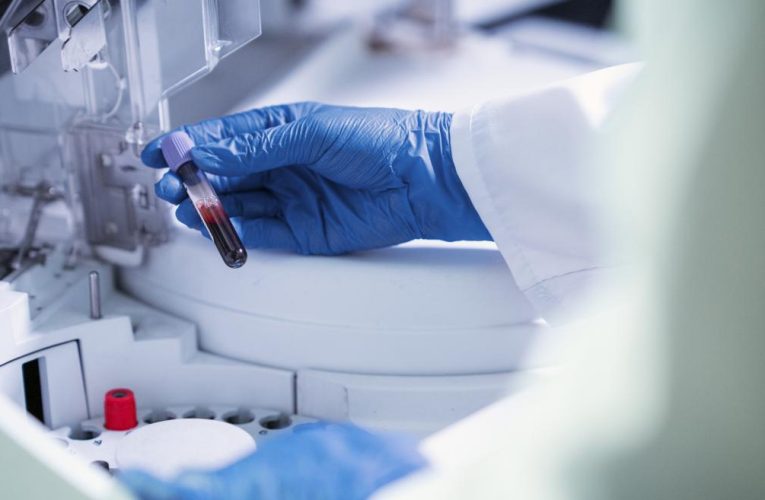 La Comunidad de Madrid invierte 120 millones de euros en la mejora de los servicios del Laboratorio Clínico Central que atiende a seis hospitales públicos