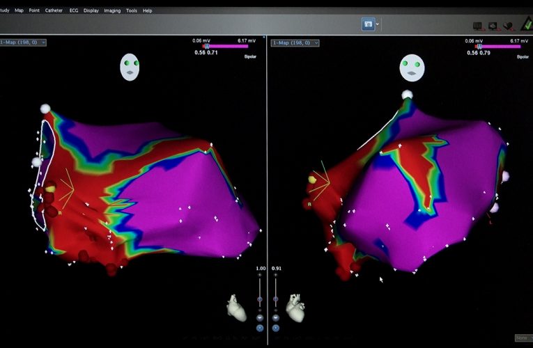 El Hospital público Gregorio Marañón colidera ‘COMPASS’, un macroproyecto europeo para proteger el corazón de los pacientes con cáncer